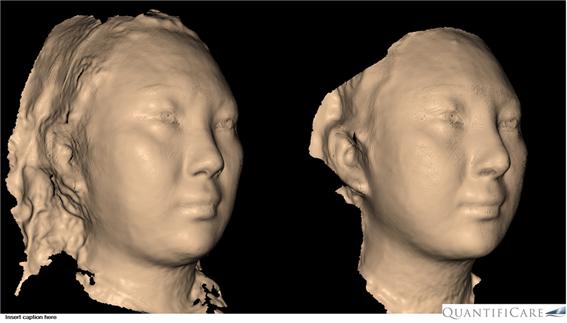 가상성형 , 라이프비즈, 얼굴지방흡입, 양악수술, 3D카메라, 피부과 진료 잘하는 곳, 피부과 치료 잘하는 곳, 강남 피부과, 압구정 피부과, 강남 압구정 피부과, 피부과 전문의, 얼굴지방흡입 치료 잘하는 곳, 지방흡입 잘하는 곳, 강남 피부과 잘하는 곳, 윤곽수술, 윤곽주사, 벨라소닉, 벨라룩스, 벨라팩트, 티셀메드