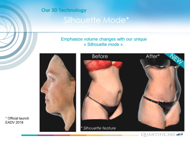 3D라이프비즈,3D카메라,라이프비즈,프랑스,피부측정기,3D카메라추천,라이프비즈사용후기,라이프비즈후기,성형외과사진기,강남성형외과,압구정성형외과,피부측정기,강남피부측정,압구정피부측정,가상성형,압구정가상성형,가상성형시술,강남가상성형,의료기기,의료장비,벨라소닉,벨라팩트,벨라룩스,벨라룩스라이트,벨라룩스LITE,압구정벨라팩트,강남벨라팩트,강남벨라룩스,압구정벨라룩스,압구정벨라소닉,강남벨라소닉,강남위드윈피부과,압구정위드윈피부과,벨라소닉치료,기미치료잘하는곳,압구정기미치료,압구정색소치료,색소치료장비추천,기미치료장비추천,기미치료,색소치료,강남색소치료,압구정색소치료,티셀메드,개원문의,개원,병원개원,개원의모임